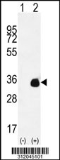 Western blot analysis of his-tag KCNIP2 (arrow) using his tag antibody. 293 cell lysates (2 ug/lane) either nontransfected (Lane 1) or transiently transfected with the KCNIP2 gene