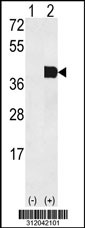 Western blot analysis of his-tag HOXB5 (arrow) using his tag antibody. 293 cell lysates (2 ug/lane) either nontransfected (Lane 1) or transiently transfected with the HOXB5 gene