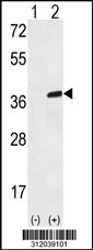 Western blot analysis of his-tag GOLPH3 (arrow) using his tag antibody. 293 cell lysates (2 ug/lane) either nontransfected (Lane 1) or transiently transfected with the GOLPH3 gene