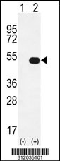Western blot analysis of his-tag GAS7 (arrow) using his tag antibody. 293 cell lysates (2 ug/lane) either nontransfected (Lane 1) or transiently transfected with the GAS7 gene