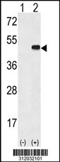 Western blot analysis of his-tag FOXP3 (arrow) using his tag antibody. 293 cell lysates (2 ug/lane) either nontransfected (Lane 1) or transiently transfected with the FOXP3 gene