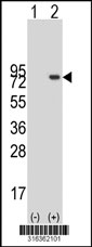Western blot analysis of his-tag FOXJ2 (arrow) using his tag antibody. 293T cell lysates (2 ug/lane) either nontransfected (Lane 1) or transiently transfected with the FOXJ2 gene‘