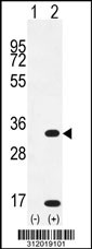 Western blot analysis of his-tag CD8B (arrow) using his tag antibody. 293 cell lysates (2 ug/lane) either nontransfected (Lane 1) or transiently transfected with the CD8B gene