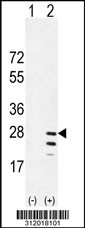 Western blot analysis of his-tag CD3G (arrow) using his tag antibody. 293 cell lysates (2 ug/lane) either nontransfected (Lane 1) or transiently transfected with the CD3G gene