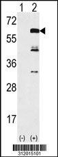 Western blot analysis of his-tag CAT (arrow) using his tag antibody. 293 cell lysates (2 ug/lane) either nontransfected (Lane 1) or transiently transfected with the CAT gene