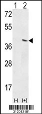 Western blot analysis of his-tag C10orf59 (arrow) using his tag antibody. 293 cell lysates (2 ug/lane) either nontransfected (Lane 1) or transiently transfected with the C10orf59 gene
