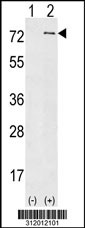 Western blot analysis of his-tag BTK (arrow) using his tag antibody. 293 cell lysates (2 ug/lane) either nontransfected (Lane 1) or transiently transfected with the BTK gene