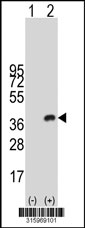 Western blot analysis of his-tag ANKRD49 (arrow) using his tag antibody. 293T cell lysates (2 ug/lane) either nontransfected (Lane 1) or transiently transfected with the ANKRD49 gene‘