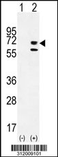 Western blot analysis of his-tag ALPL (arrow) using his tag antibody. 293 cell lysates (2 ug/lane) either nontransfected (Lane 1) or transiently transfected with the ALPL gene