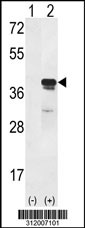 Western blot analysis of his-tag ACOT8 (arrow) using his tag antibody. 293 cell lysates (2 ug/lane) either nontransfected (Lane 1) or transiently transfected with the ACOT8 gene