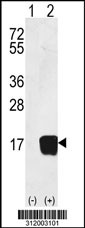 Western blot analysis of his-tag THEM2 (arrow) using his tag antibody. 293 cell lysates (2 ug/lane) either nontransfected (Lane 1) or transiently transfected with the THEM2 gene