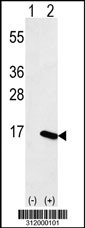 Western blot analysis of his-tag SLC39A3 (arrow) using his tag antibody. 293 cell lysates (2 ug/lane) either nontransfected (Lane 1) or transiently transfected with the SLC39A3 gene