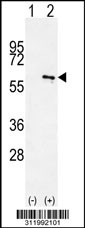 Western blot analysis of his-tag PKLR (arrow) using his tag antibody. 293 cell lysates (2 ug/lane) either nontransfected (Lane 1) or transiently transfected with the PKLR gene