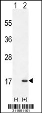 Western blot analysis of his-tag MLLT10 (arrow) using his tag antibody. 293 cell lysates (2 ug/lane) either nontransfected (Lane 1) or transiently transfected with the MLLT10 gene