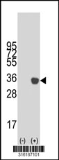 Western blot analysis of his-tag FBXL15 (arrow) using his tag antibody. 293T cell lysates (2 ug/lane) either nontransfected (Lane 1) or transiently transfected with the FBXL15 gene‘