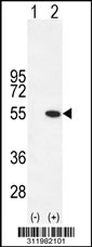 Western blot analysis of his-tag HGD (arrow) using his tag antibody. 293 cell lysates (2 ug/lane) either nontransfected (Lane 1) or transiently transfected with the HGD gene