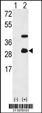 Western blot analysis of his-tag FKBP14 (arrow) using his tag antibody. 293 cell lysates (2 ug/lane) either nontransfected (Lane 1) or transiently transfected with the FKBP14 gene