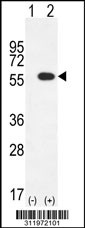 Western blot analysis of his-tag CYP2E1 (arrow) using his tag antibody. 293 cell lysates (2 ug/lane) either nontransfected (Lane 1) or transiently transfected with the CYP2E1 gene
