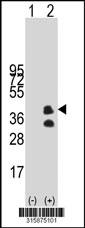 Western blot analysis of his-tag TSPAN17 (arrow) using his tag antibody. 293T cell lysates (2 ug/lane) either nontransfected (Lane 1) or transiently transfected with the TSPAN17 gene‘