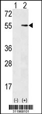 Western blot analysis of his-tag C9orf156 (arrow) using his tag antibody. 293 cell lysates (2 ug/lane) either nontransfected (Lane 1) or transiently transfected with the C9orf156 gene
