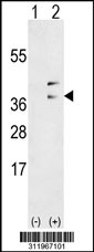 Western blot analysis of his-tag C1QBP (arrow) using his tag antibody. 293 cell lysates (2 ug/lane) either nontransfected (Lane 1) or transiently transfected with the C1QBP gene