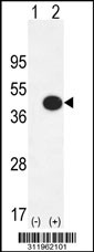 Western blot analysis of his-tag AHSA1 (arrow) using his tag antibody. 293 cell lysates (2 ug/lane) either nontransfected (Lane 1) or transiently transfected with the AHSA1 gene