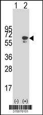 Western blot analysis of his-tag FBXO46 (arrow) using his tag antibody. 293T cell lysates (2 ug/lane) either nontransfected (Lane 1) or transiently transfected with the FBXO46 gene‘