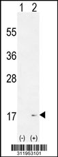 Western blot analysis of his-tag MGST2 (arrow) using his tag antibody. 293 cell lysates (2 ug/lane) either nontransfected (Lane 1) or transiently transfected with the MGST2 gene