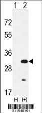 Western blot analysis of his-tag LIN28 (arrow) using his tag antibody. 293 cell lysates (2 ug/lane) either nontransfected (Lane 1) or transiently transfected with the LIN28 gene