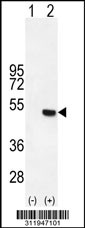 Western blot analysis of his-tag JMJD2B (arrow) using his tag antibody. 293 cell lysates (2 ug/lane) either nontransfected (Lane 1) or transiently transfected with the JMJD2B gene