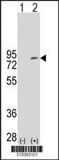 Western blot analysis of his-tag FBXL5 (arrow) using his tag antibody. 293T cell lysates (2 ug/lane) either nontransfected (Lane 1) or transiently transfected with the FBXL5 gene‘