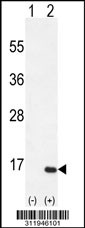 Western blot analysis of his-tag GALNT3 (arrow) using his tag antibody. 293 cell lysates (2 ug/lane) either nontransfected (Lane 1) or transiently transfected with the GALNT3 gene