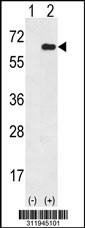 Western blot analysis of his-tag F10 (arrow) using his tag antibody. 293 cell lysates (2 ug/lane) either nontransfected (Lane 1) or transiently transfected with the F10 gene