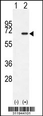 Western blot analysis of his-tag EIF2AK4 (arrow) using his tag antibody. 293 cell lysates (2 ug/lane) either nontransfected (Lane 1) or transiently transfected with the EIF2AK4 gene