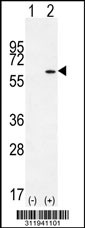 Western blot analysis of his-tag CYP27A1 (arrow) using his tag antibody. 293 cell lysates (2 ug/lane) either nontransfected (Lane 1) or transiently transfected with the CYP27A1 gene