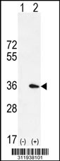 Western blot analysis of his-tag ARGLU1 (arrow) using his tag antibody. 293 cell lysates (2 ug/lane) either nontransfected (Lane 1) or transiently transfected with the ARGLU1 gene