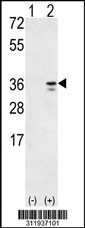 Western blot analysis of his-tag ADAM17 (arrow) using his tag antibody. 293 cell lysates (2 ug/lane) either nontransfected (Lane 1) or transiently transfected with the ADAM17 gene