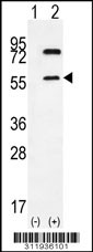 Western blot analysis of his-tag ACVR2A (arrow) using his tag antibody. 293 cell lysates (2 ug/lane) either nontransfected (Lane 1) or transiently transfected with the ACVR2A gene