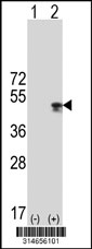Western blot analysis of his-tag FBXL14 (arrow) using his tag antibody. 293T cell lysates (2 ug/lane) either nontransfected (Lane 1) or transiently transfected with the FBXL14 gene‘