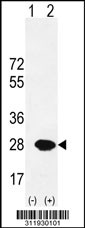 Western blot analysis of his-tag SDS (arrow) using his tag antibody. 293 cell lysates (2 ug/lane) either nontransfected (Lane 1) or transiently transfected with the SDS gene