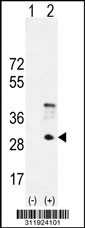 Western blot analysis of his-tag ORM1 (arrow) using his tag antibody. 293 cell lysates (2 ug/lane) either nontransfected (Lane 1) or transiently transfected with the ORM1 gene