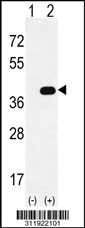 Western blot analysis of his-tag MEOX1 (arrow) using his tag antibody. 293 cell lysates (2 ug/lane) either nontransfected (Lane 1) or transiently transfected with the MEOX1 gene
