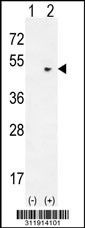 Western blot analysis of his-tag KIAA1303 (arrow) using his tag antibody. 293 cell lysates (2 ug/lane) either nontransfected (Lane 1) or transiently transfected with the KIAA1303 gene