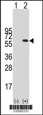 Western blot analysis of his-tag FAM82A2 (arrow) using his tag antibody. 293T cell lysates (2 ug/lane) either nontransfected (Lane 1) or transiently transfected with the FAM82A2 gene‘