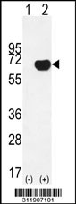 Western blot analysis of his-tag ETV6 (arrow) using his tag antibody. 293 cell lysates (2 ug/lane) either nontransfected (Lane 1) or transiently transfected with the ETV6 gene