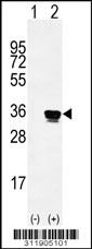 Western blot analysis of his-tag DKKL1 (arrow) using his tag antibody. 293 cell lysates (2 ug/lane) either nontransfected (Lane 1) or transiently transfected with the DKKL1 gene