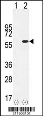 Western blot analysis of his-tag CYP3A4 (arrow) using his tag antibody. 293 cell lysates (2 ug/lane) either nontransfected (Lane 1) or transiently transfected with the CYP3A4 gene