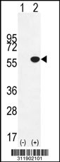 Western blot analysis of his-tag CYP2C18 (arrow) using his tag antibody. 293 cell lysates (2 ug/lane) either nontransfected (Lane 1) or transiently transfected with the CYP2C18 gene