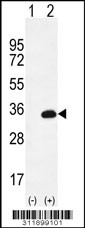 Western blot analysis of his-tag CMA1 (arrow) using his tag antibody. 293 cell lysates (2 ug/lane) either nontransfected (Lane 1) or transiently transfected with the CMA1 gene