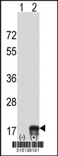 Western blot analysis of his-tag UBE2D4 (arrow) using his tag antibody. 293T cell lysates (2 ug/lane) either nontransfected (Lane 1) or transiently transfected with the UBE2D4 gene‘